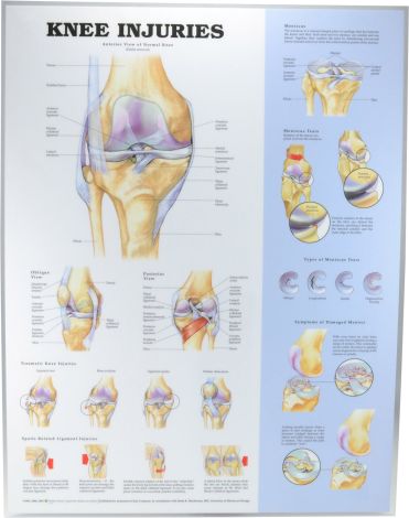 Knee Injuries Poster 51 x 66cm Laminated - KNEEL , 