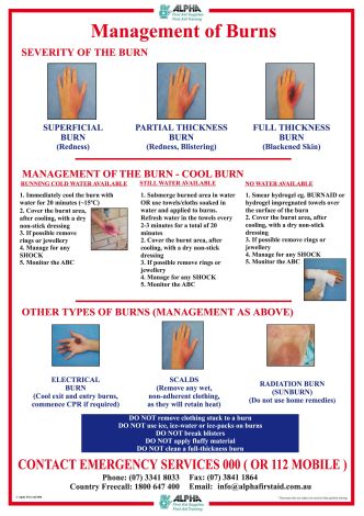 Burns Poster A3 Laminated - POS008 , 