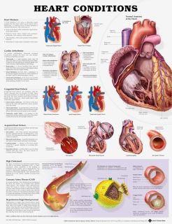 Heart Conditions Poster 51 x 66cm Laminated - HEACSL , 