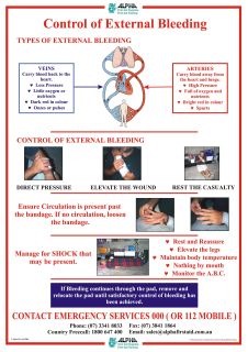 Bleeding Poster A3 Laminated - POS006 , 