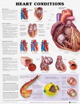 Heart Conditions Poster 51 x 66cm Laminated - HEACSL , 
