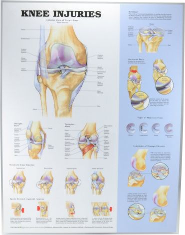 Knee Injuries Poster 51 x 66cm Laminated - KNEEL , 