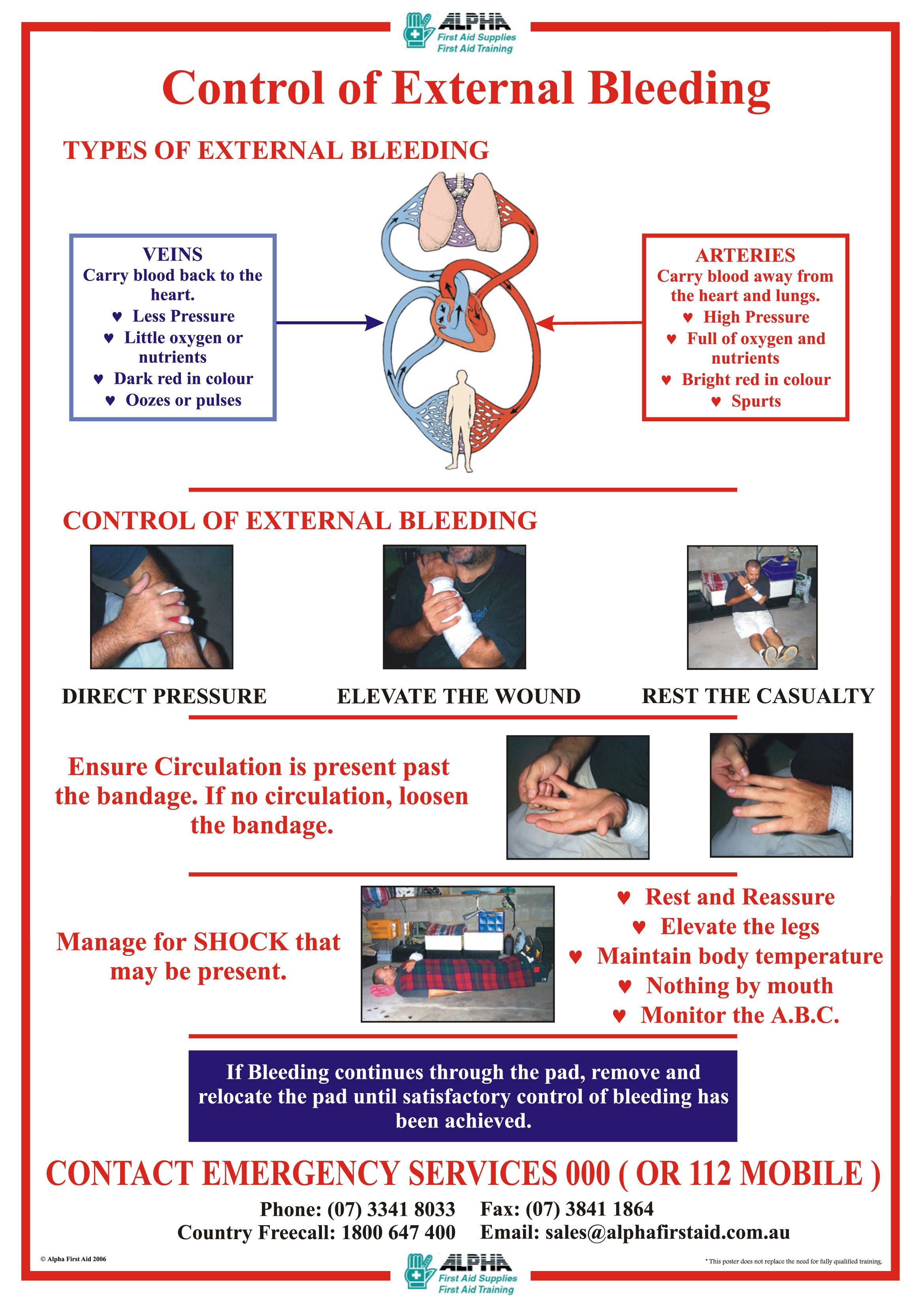 Bleeding Poster A3 Laminated