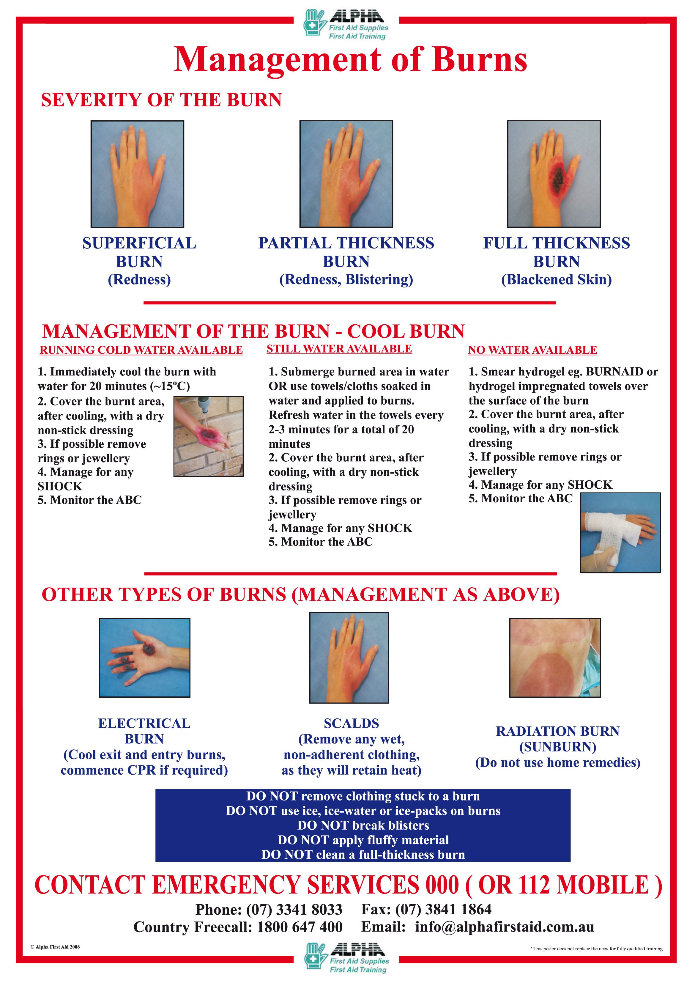Burns Poster A3 Laminated