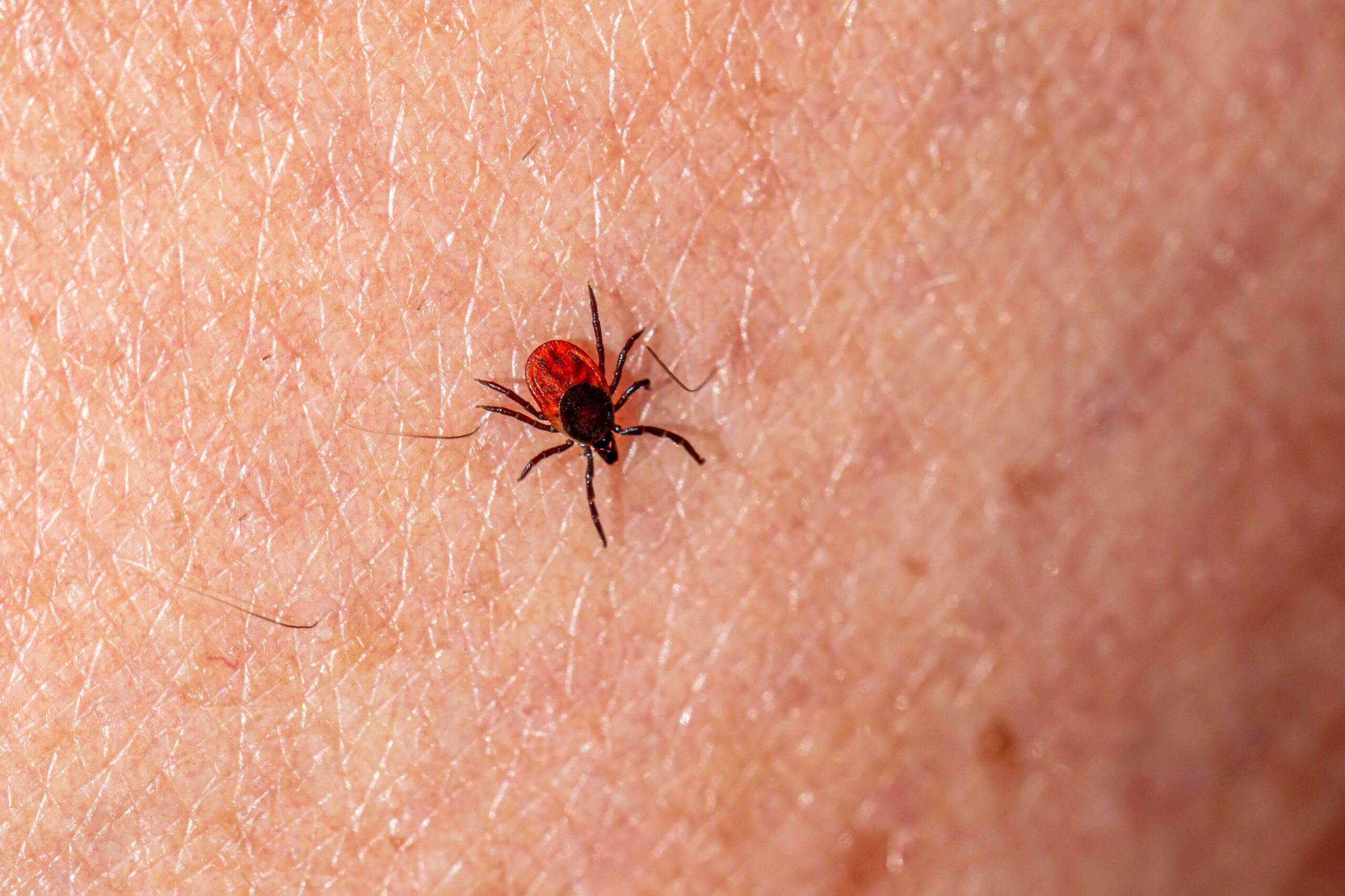 Australian bites and stings first aid with snake bite kit