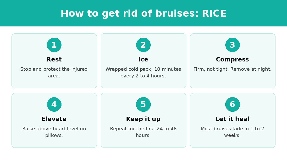 How to get rid of bruises with RICE: rest, ice 10 minutes every 2 to 4 hours, compress firmly, elevate, then let it heal over 1 to 2 weeks